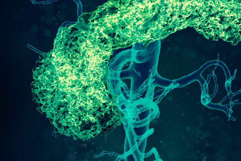 Trastornos cardiometabólicos